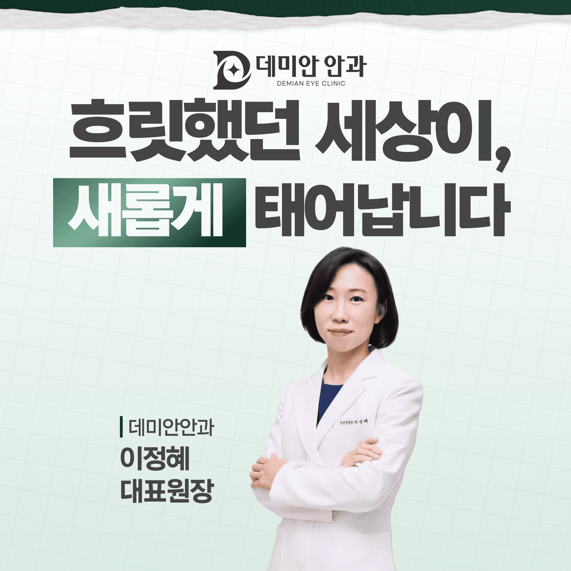 세류역안과 올레이저라섹, 각막이 얇아도 가능한지 기준 확인하기