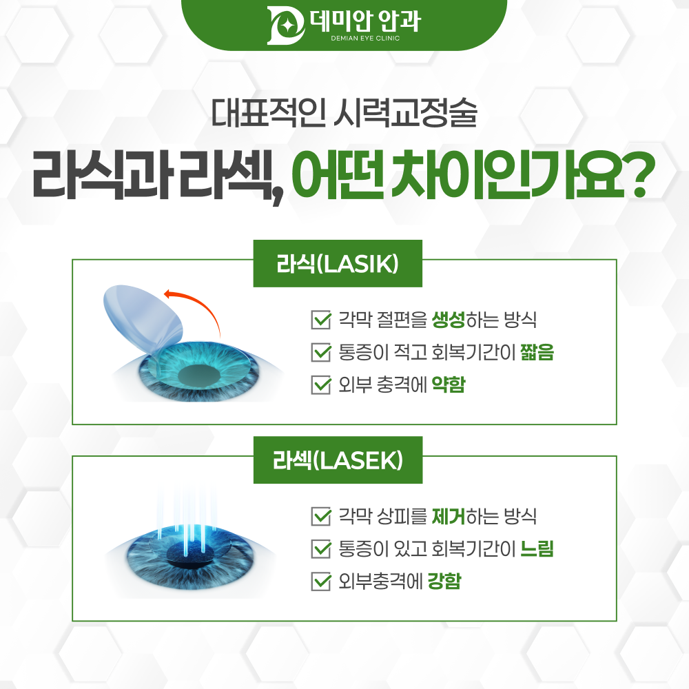 스마일라식 각막 2mm 미세절개 원리 안내 이미지