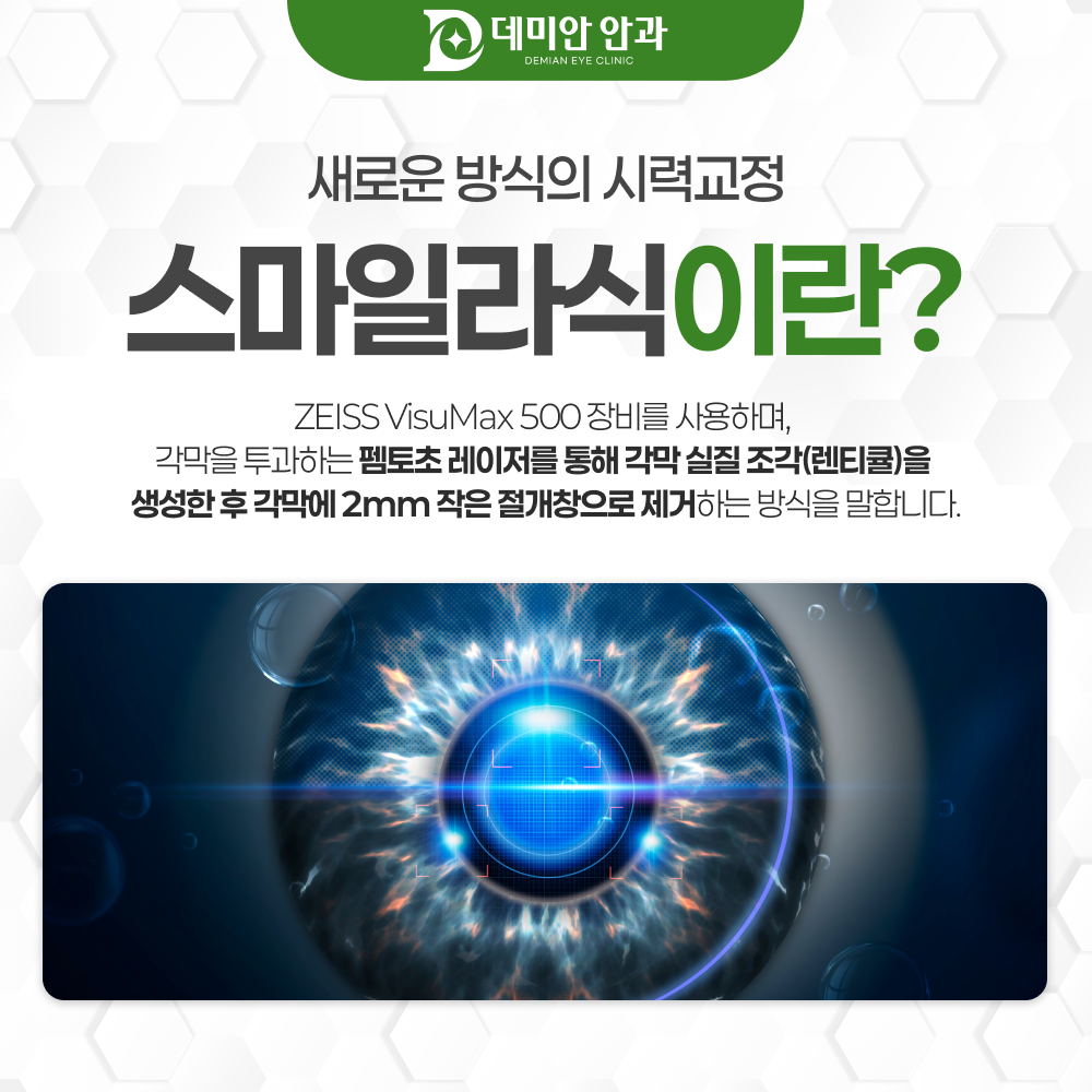 자이스 비쥬맥스500 펨토초 레이저 장비 안내 이미지